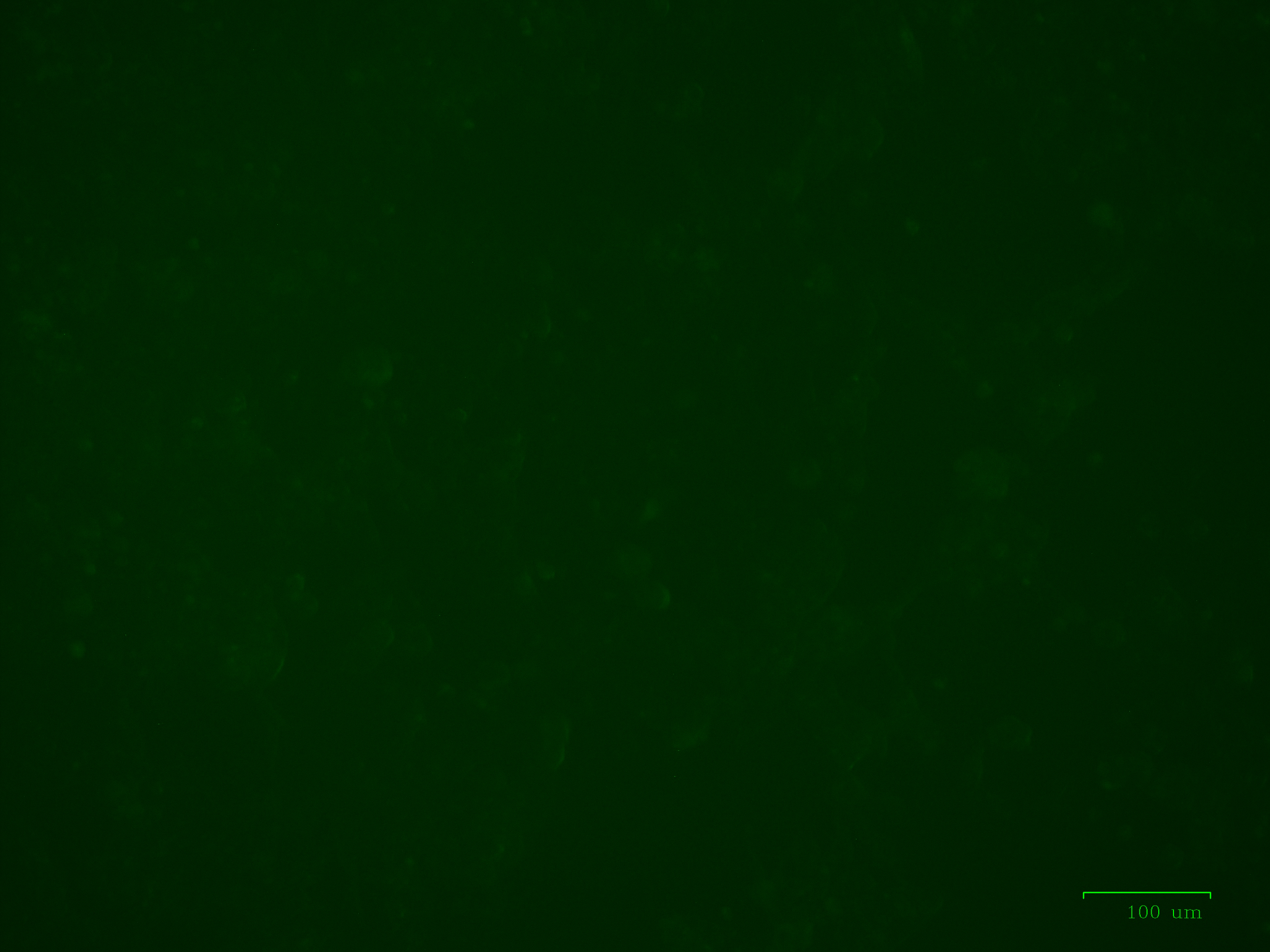 293 cells infected with Cat. No. AAV101 AAV-CMV-DIO-copGFP Vector only (i.e. absence of CRE)