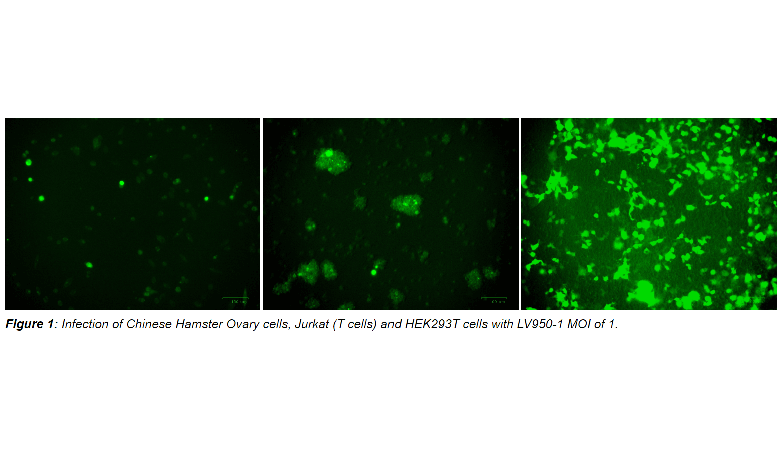 Lentivirus Promoter Blast™ kit