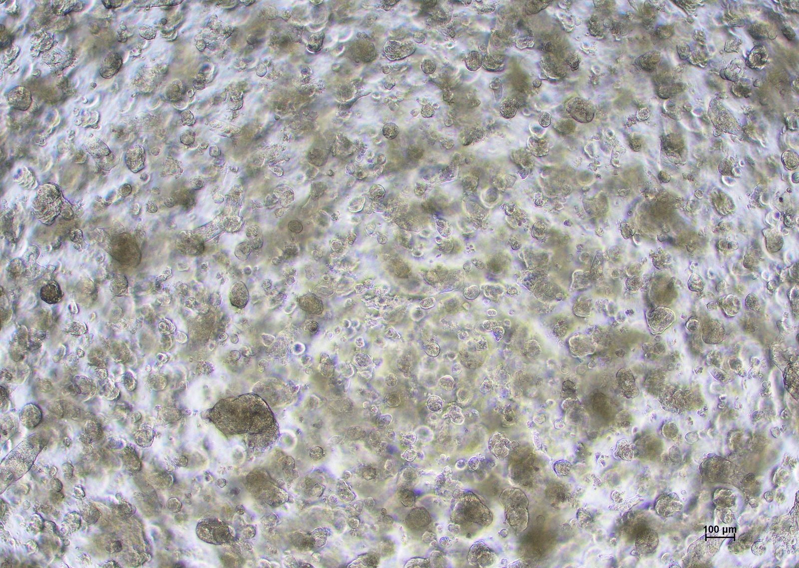 HCC827 cells in competitor medium on day 7 at 4x magnification