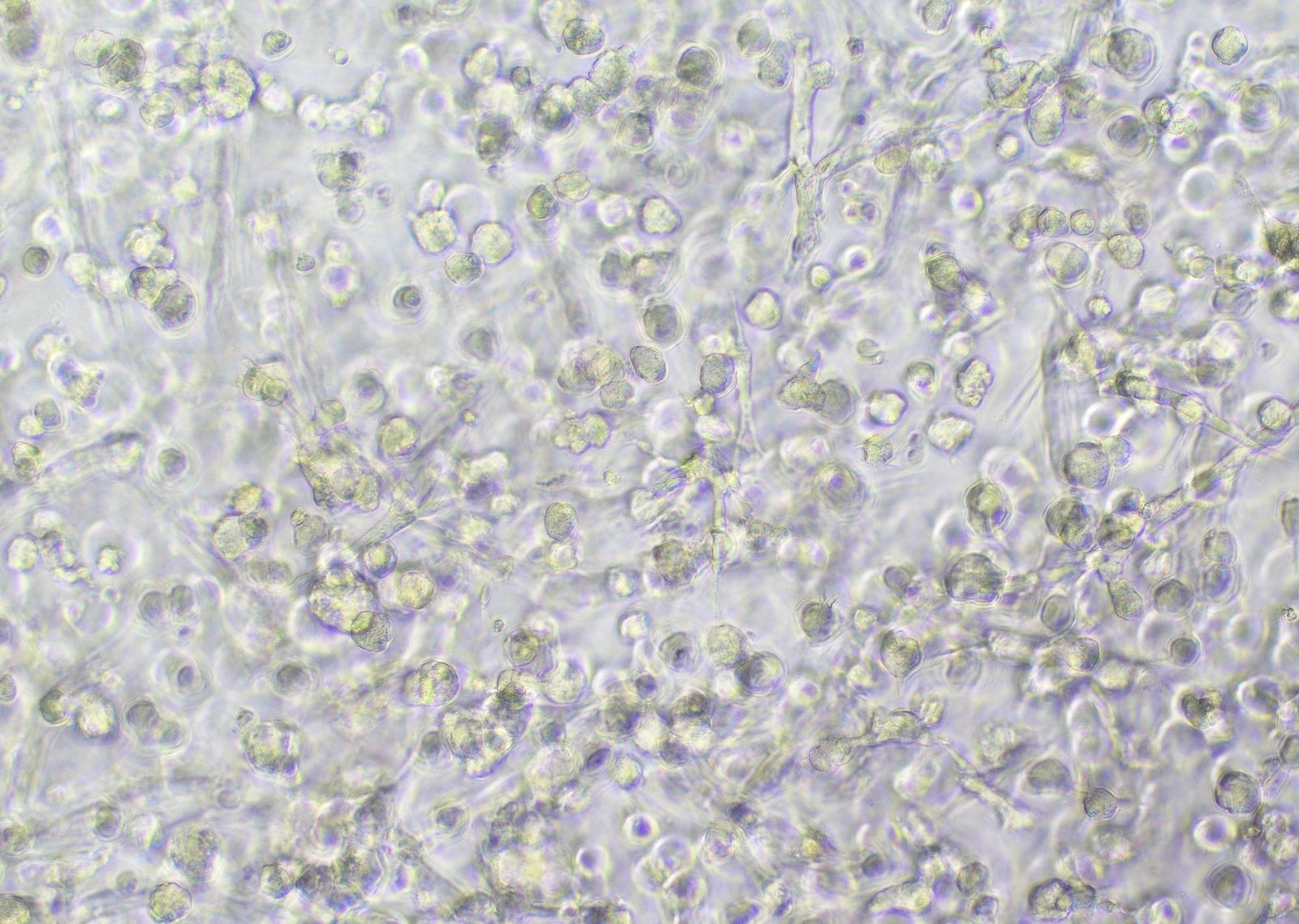 U251N cells in competitor medium on day 3 at 10x magnification