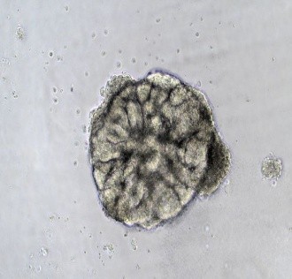 Human kidney organoid cultured in 3DCelMatrix ECM solution