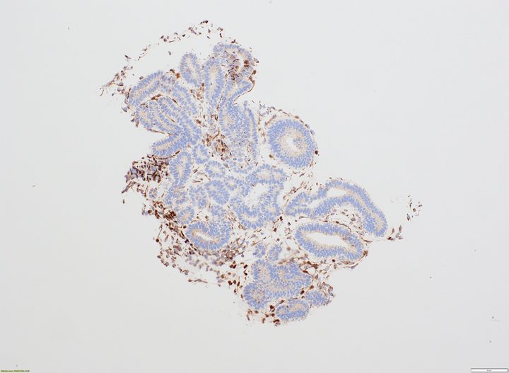 WT1 IHC staining in kidney organoids