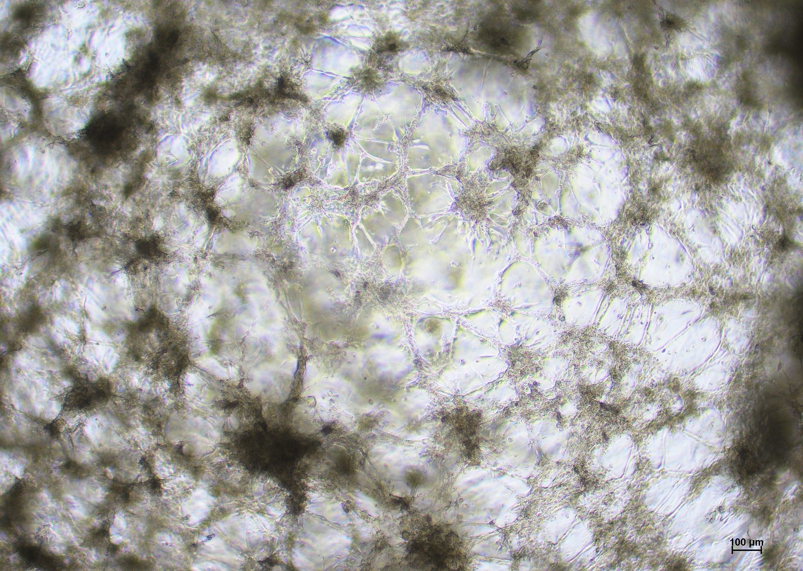 BT-549 cells in abm TM602 medium on day 7 at 4x magnification