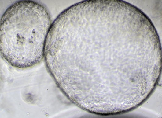 Mouse small intestine organoid example
