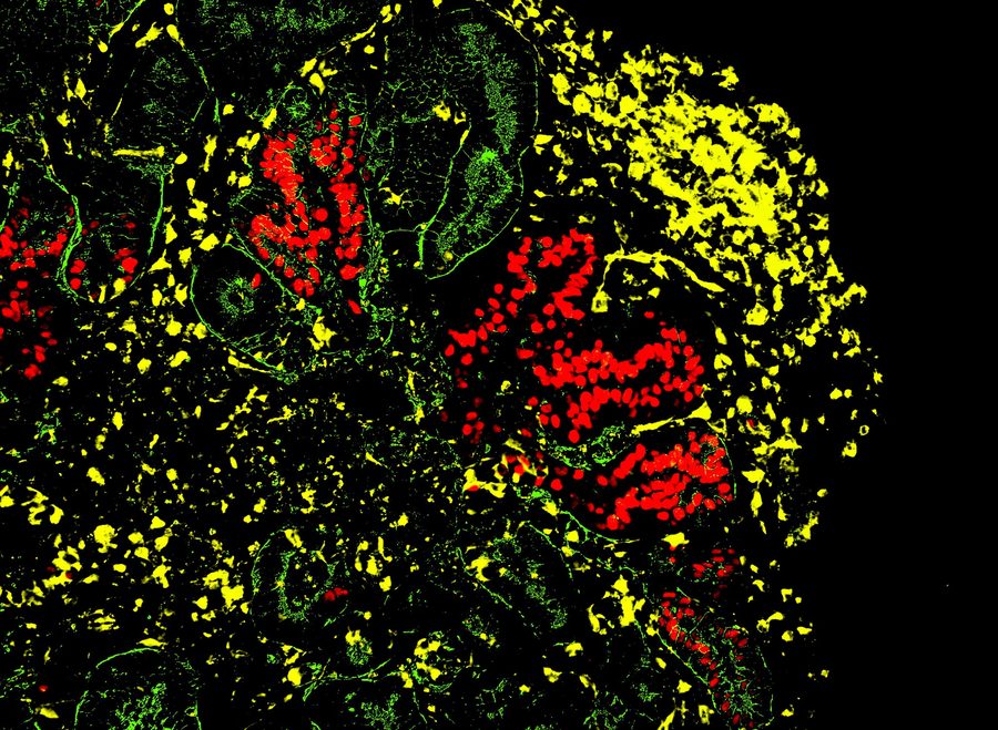 WT1 GATA3 LTL immunofluorescence staining in kidney organoids