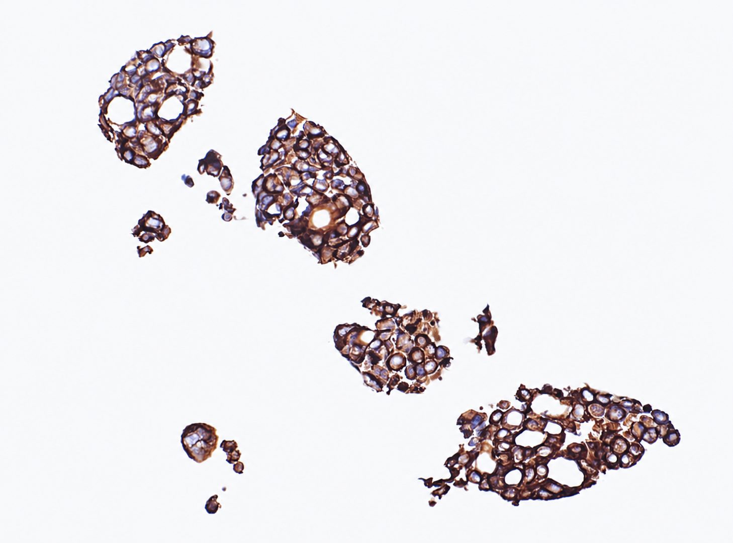 CK7 positive bronchial epithelial organoids generated with TM601