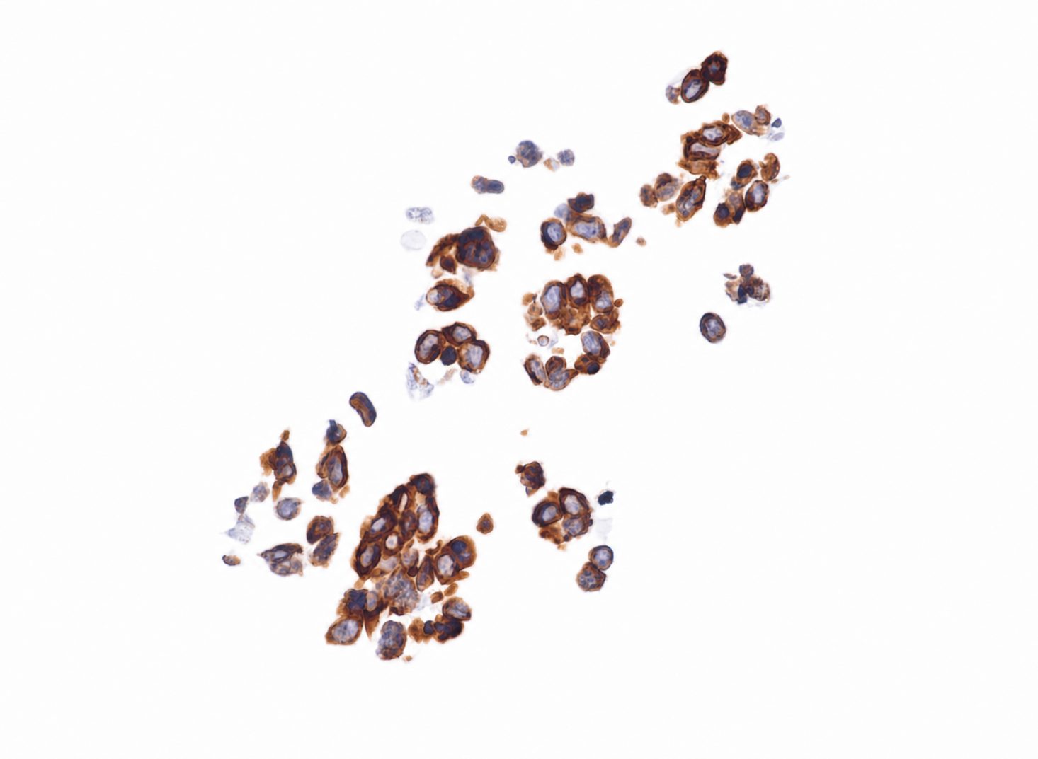 Nestin strong positive brain organoids generated with TM603