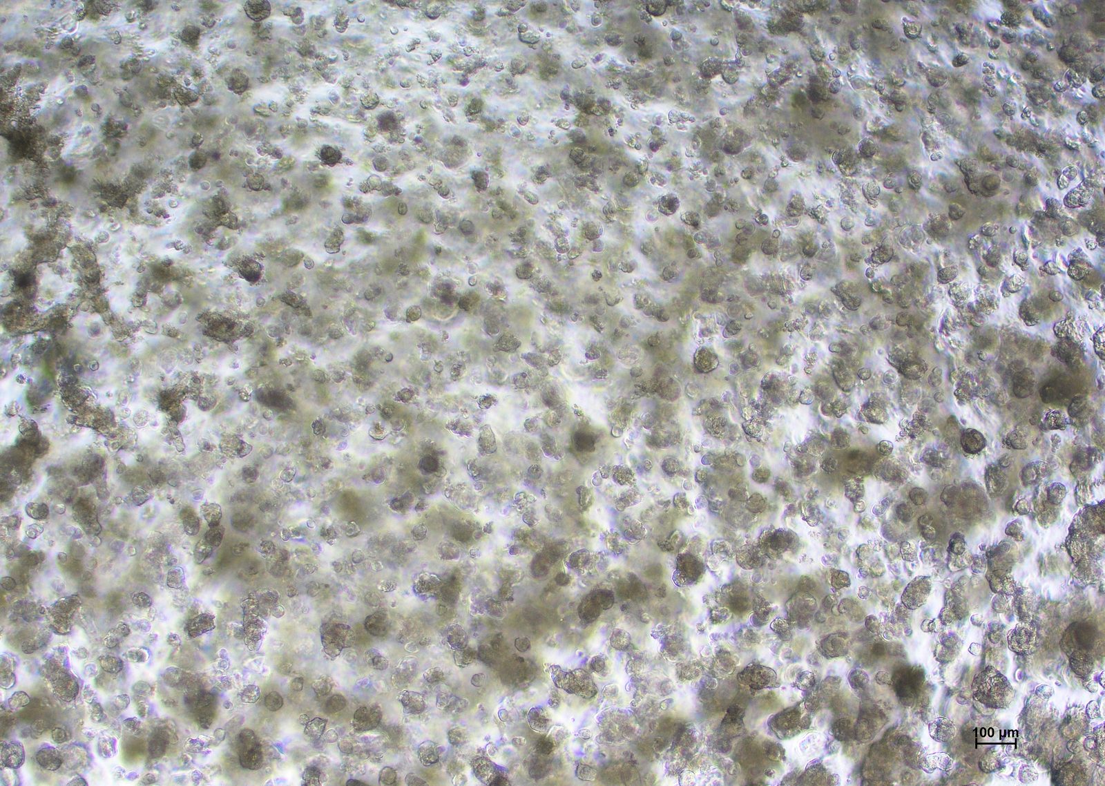 HCC827 cells in abm TM601 medium on day 7 at 4x magnification