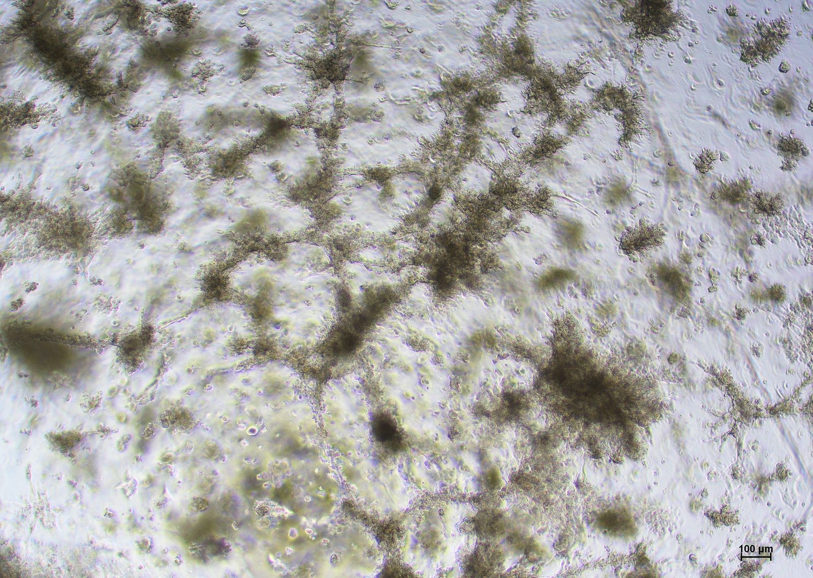 BT-549 cells in competitor medium on day 7 at 4x magnification