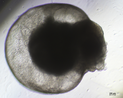 Heart organoid morphology example