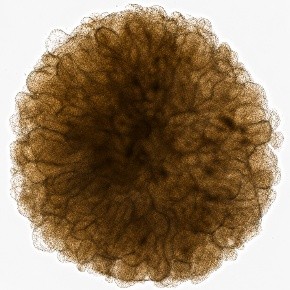 Human midbrain organoid morphology supported by 3DCelMatrix