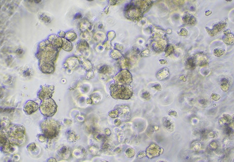 TNBC tumour organoid model example