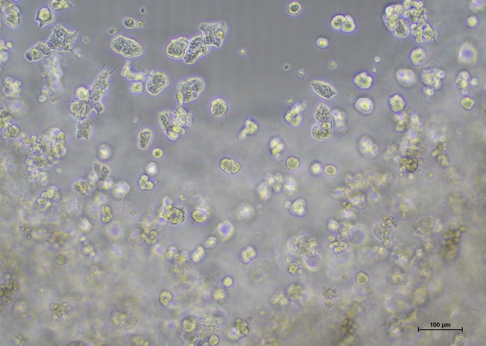 NCI-H460 cells in competitor medium on day 5 at 10x magnification