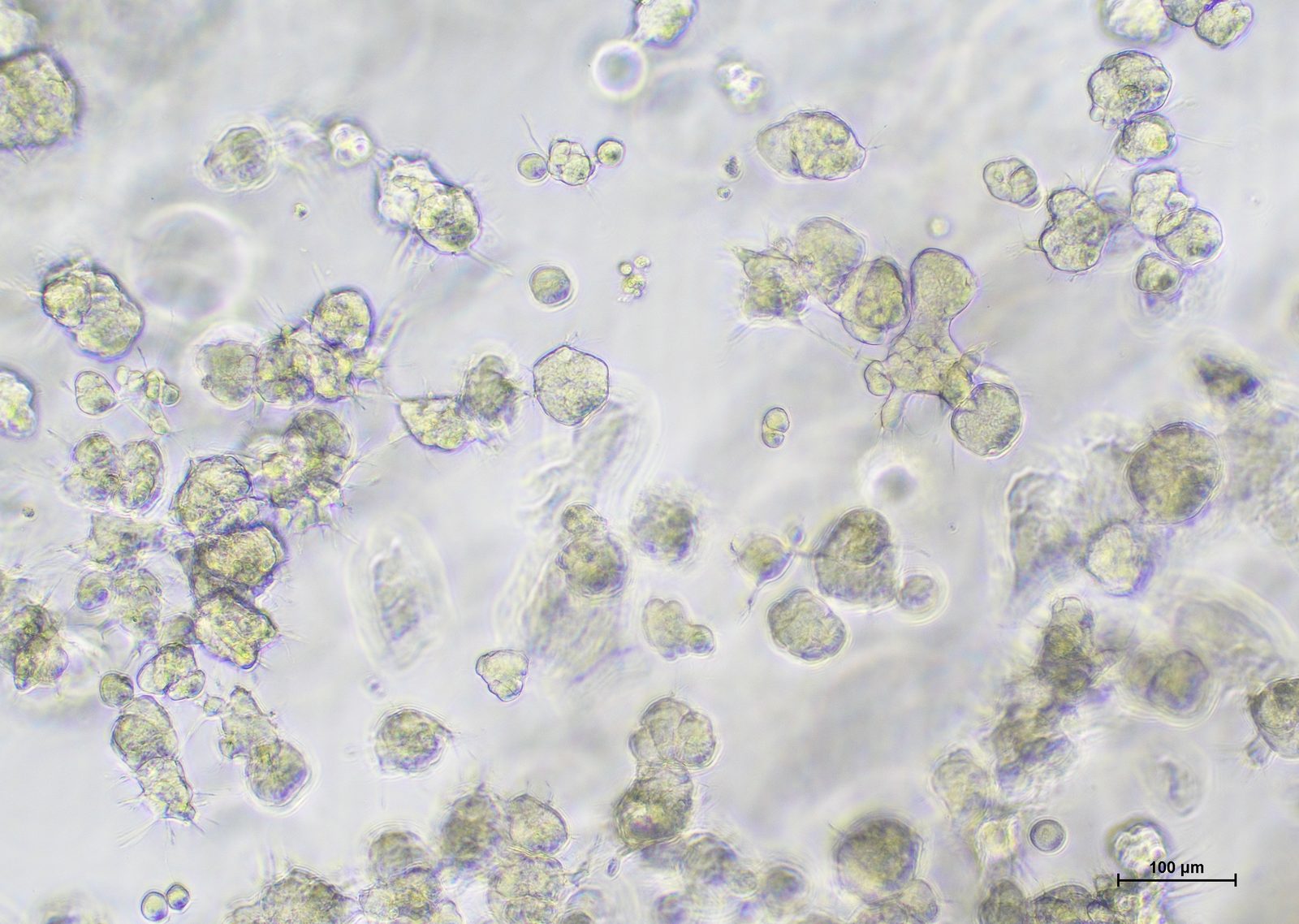 NCI-H460 cells in abm TM600 medium on day 5 at 10x magnification