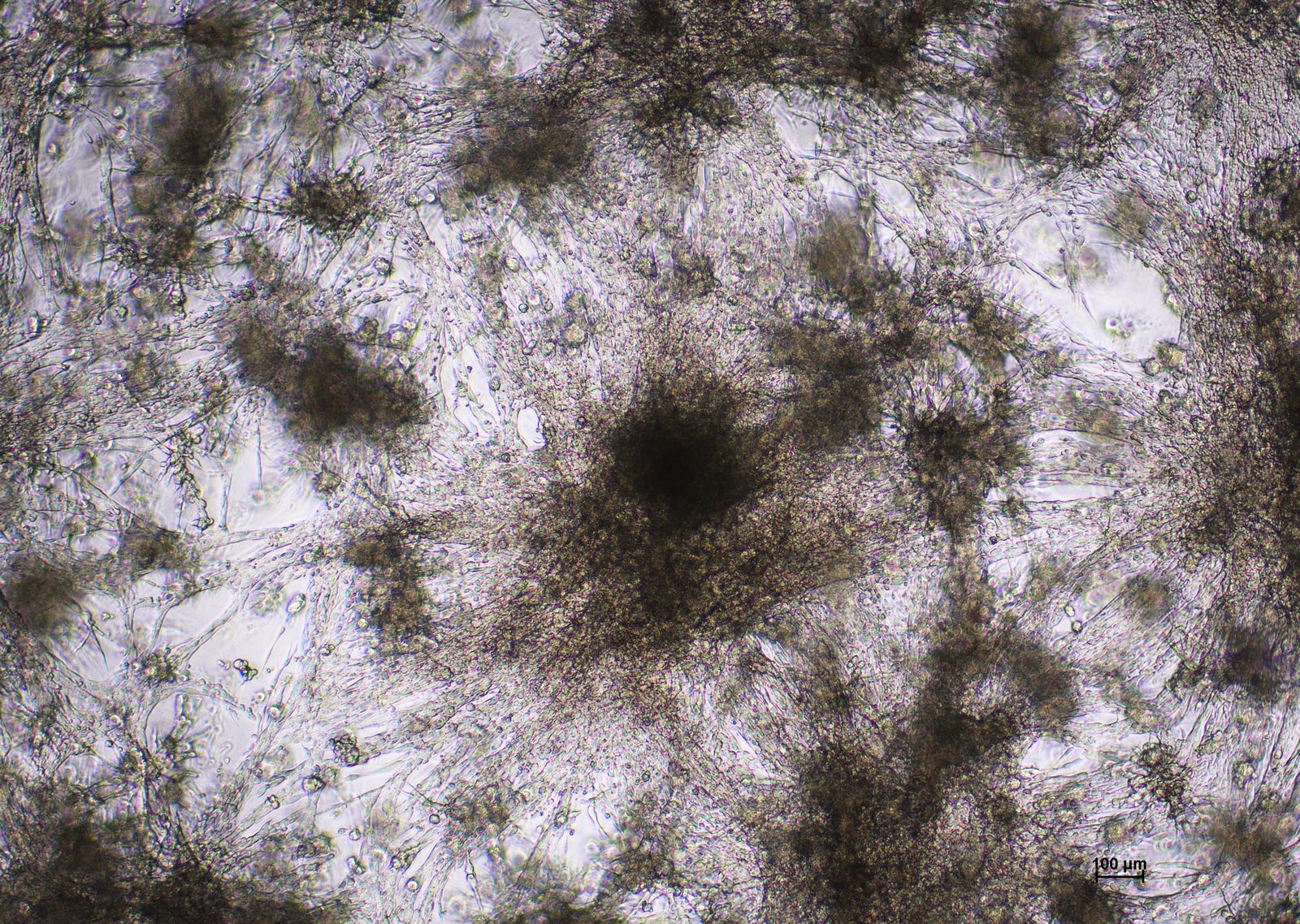 U251N cells in abm TM603 medium on day 7 at 4x magnification