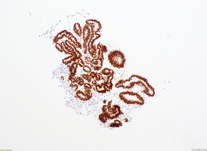 PAX8 IHC staining in kidney organoids