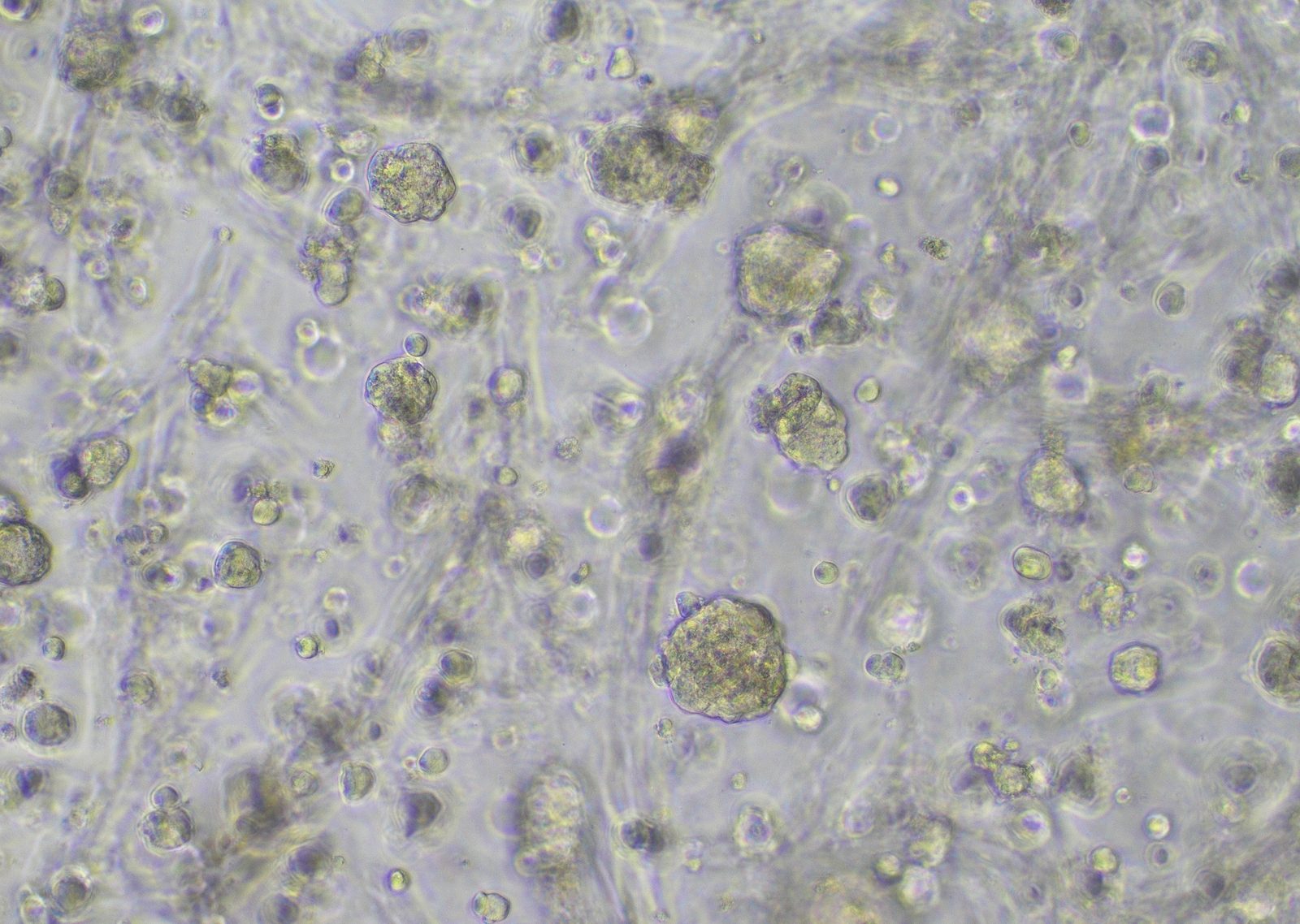 U251N cells in abm TM603 medium on day 3 at 10x magnification