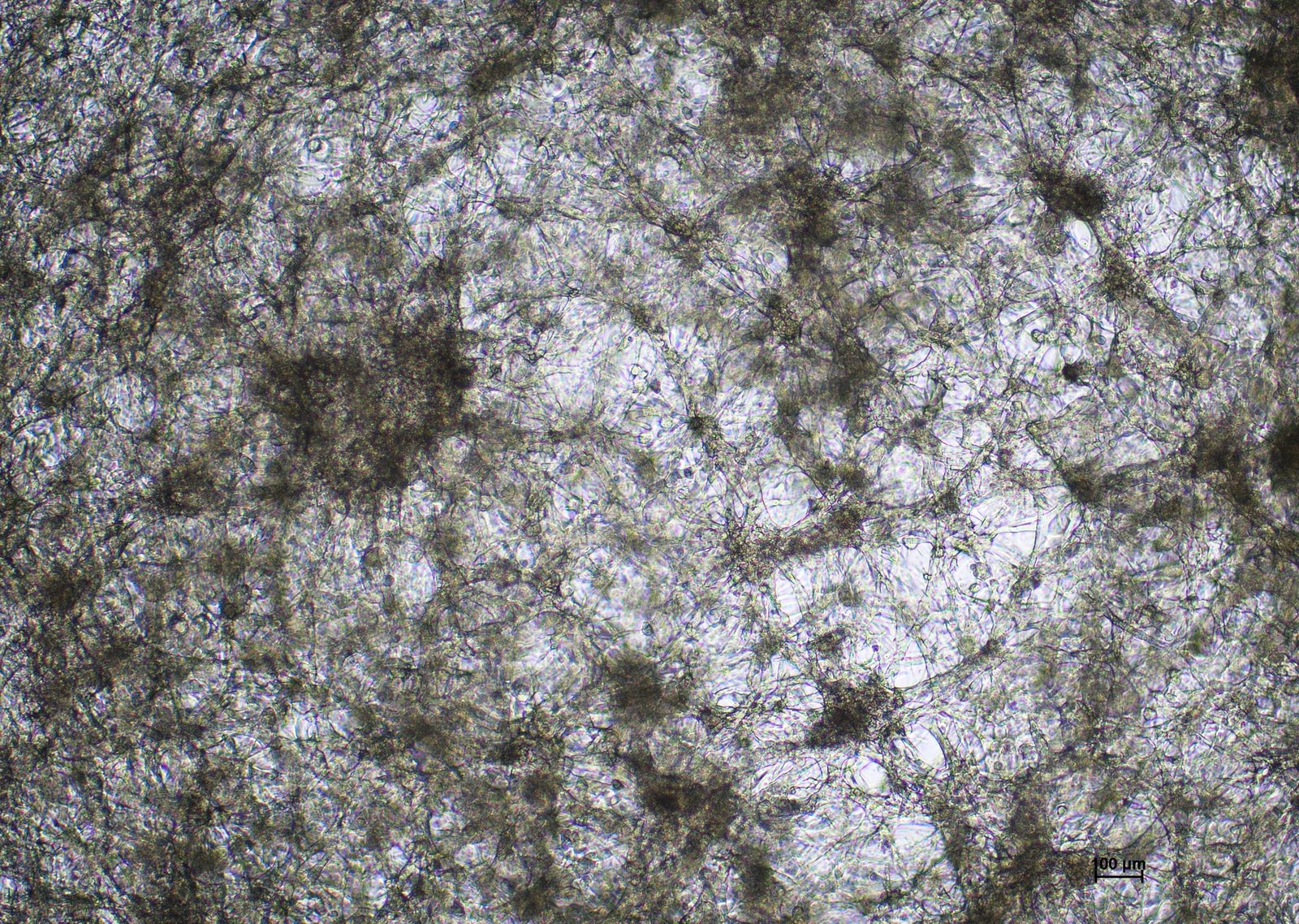 U251N cells in competitor medium on day 7 at 4x magnification
