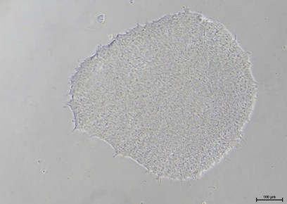 Human iPSC colony cultured in 3DCelMatrix ECM solution