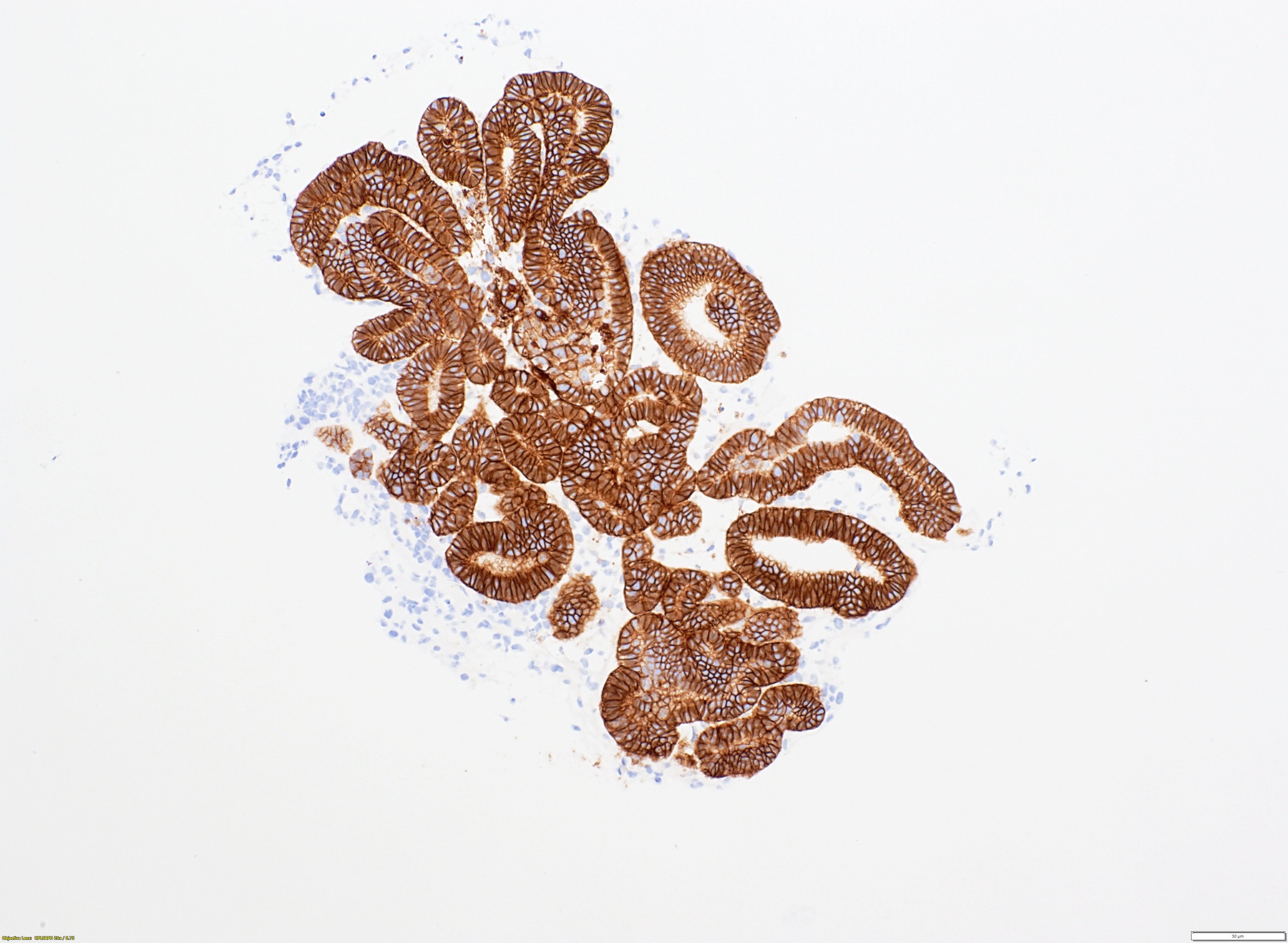Kidney organoid EPCAM staining example