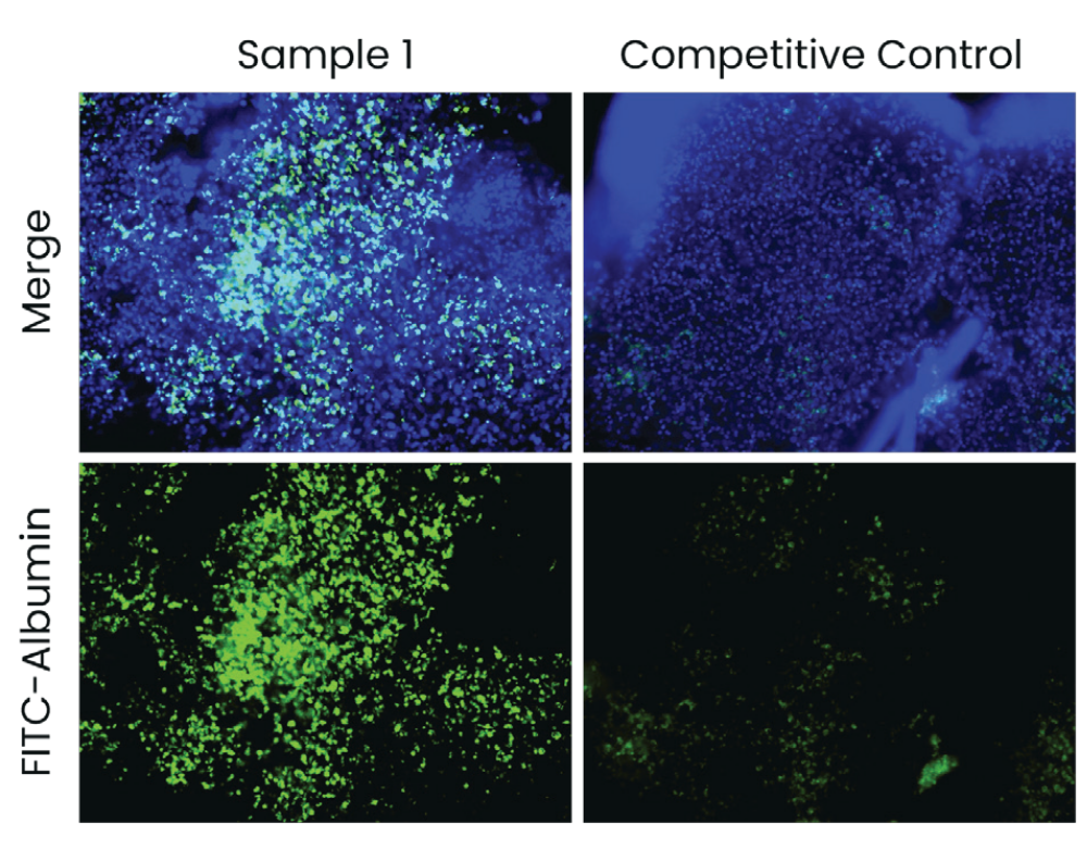 2-NBDG glucose uptake assay panel with negative control, 4 degrees Celsius, 37 degrees Celsius, and competitive control